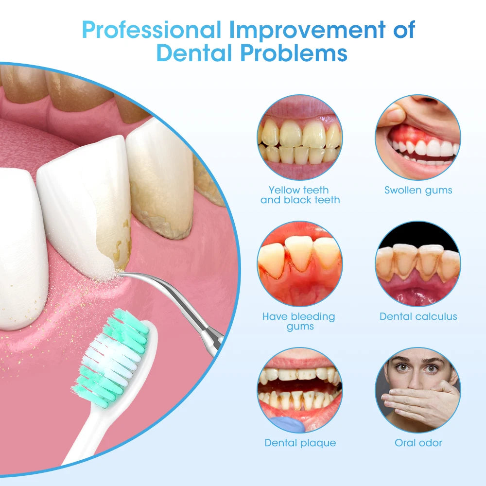 Dental Calculus Removal